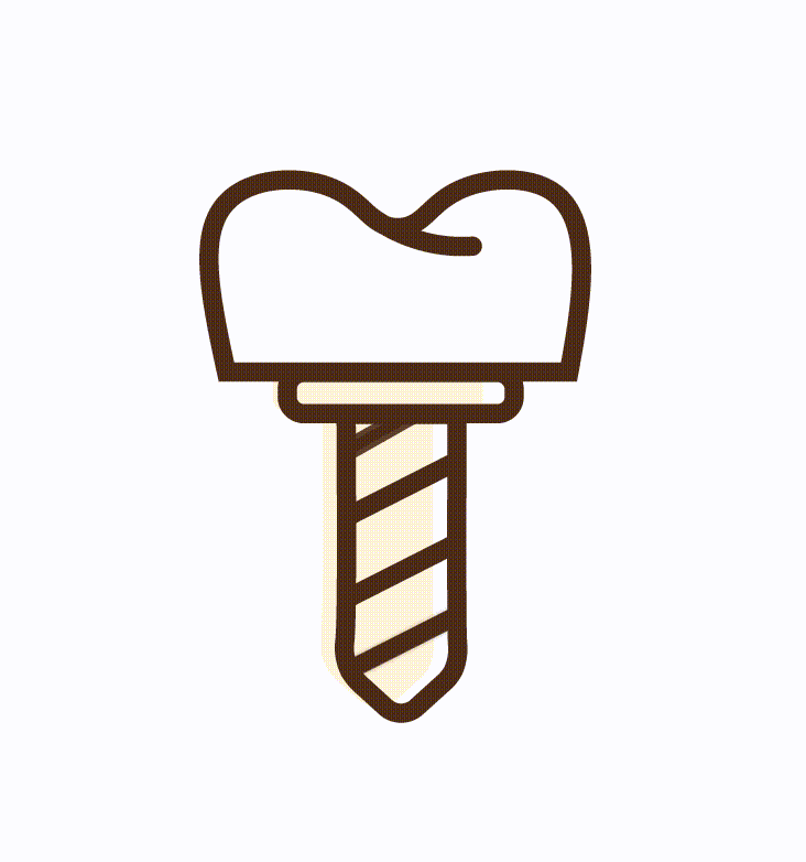 Dental Implants / Teeth Implants