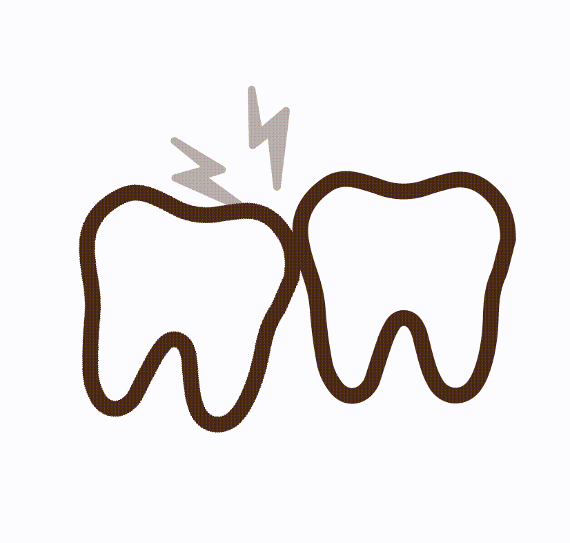 Wisdom Teeth Removal